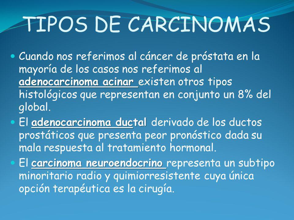 tratamiento de la próstata con adenocarcinoma acinado tratamiento de la próstata con adenocarcinoma acinado